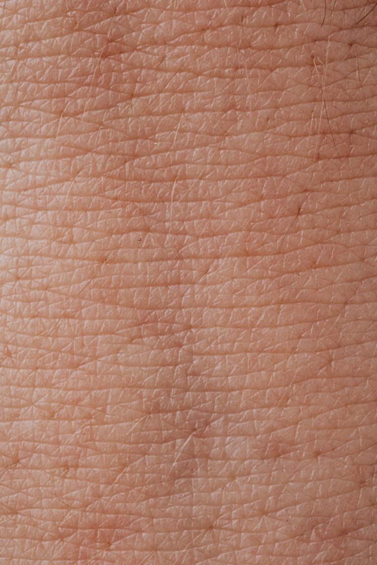cildiye1